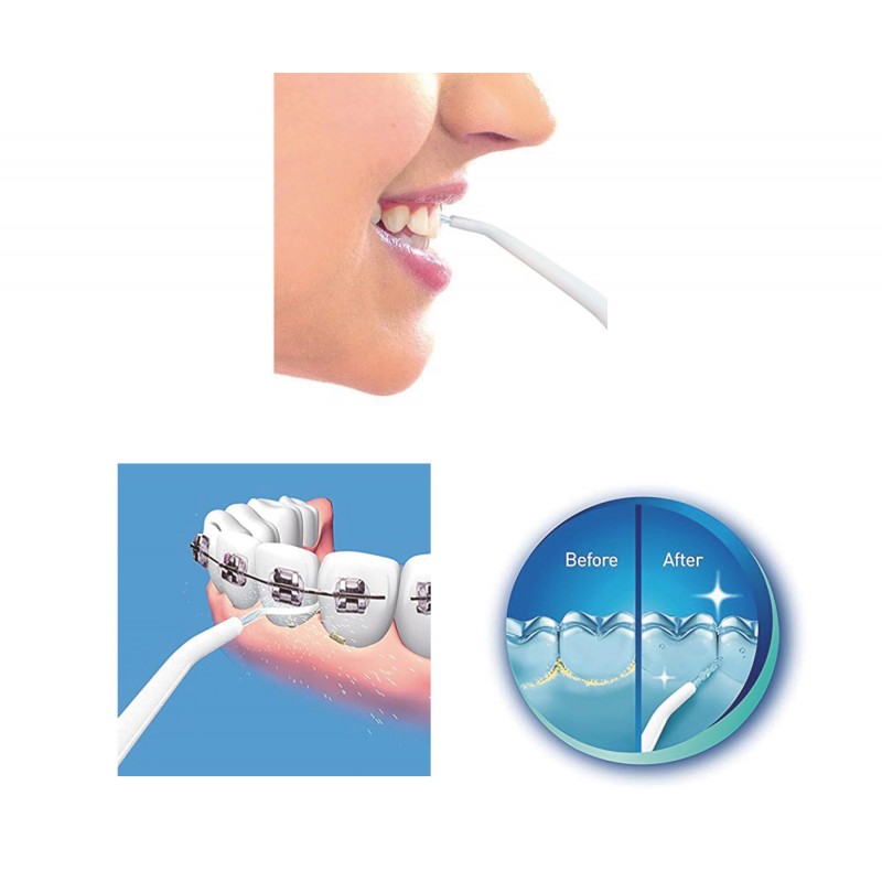 Irrigador Dental