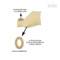 Hallux valgus