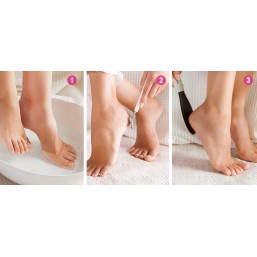 Cepicallos Herbifeet 6303.1